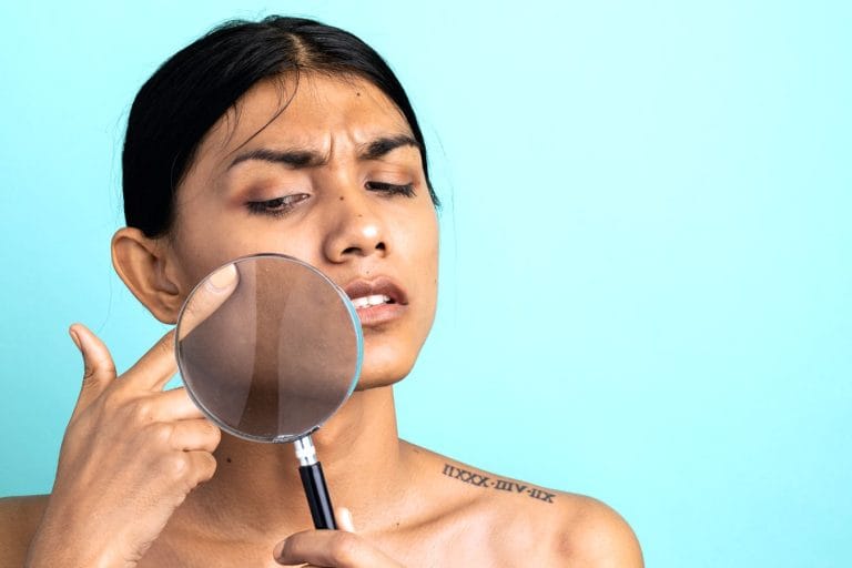 pores dilatés quoi faire