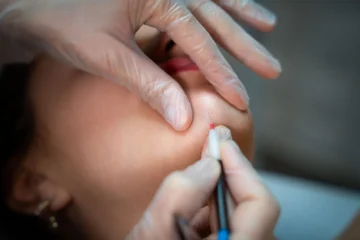 Pourquoi j’ai choisi l’électrolyse et la thermolyse pour une épilation vraiment définitive