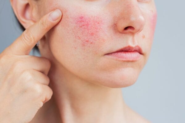 découvrez comment les soins anti imperfection peuvent vous aider