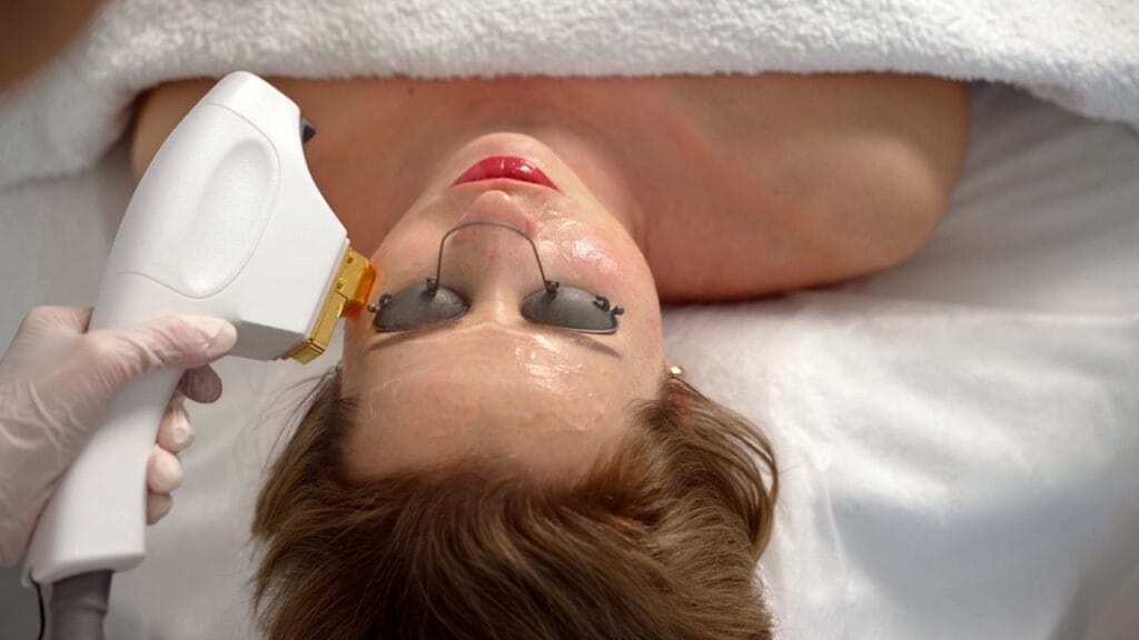 Femme soin du visage contre l'acné PCME