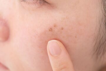 Est-ce que le sérum anti-taches fonctionne sur tous les types de taches ?