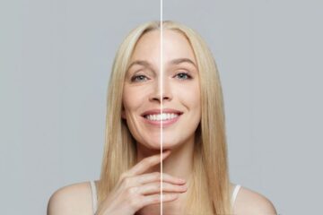 Acide hyaluronique et collagène : lequel choisir pour une peau éclatante ?